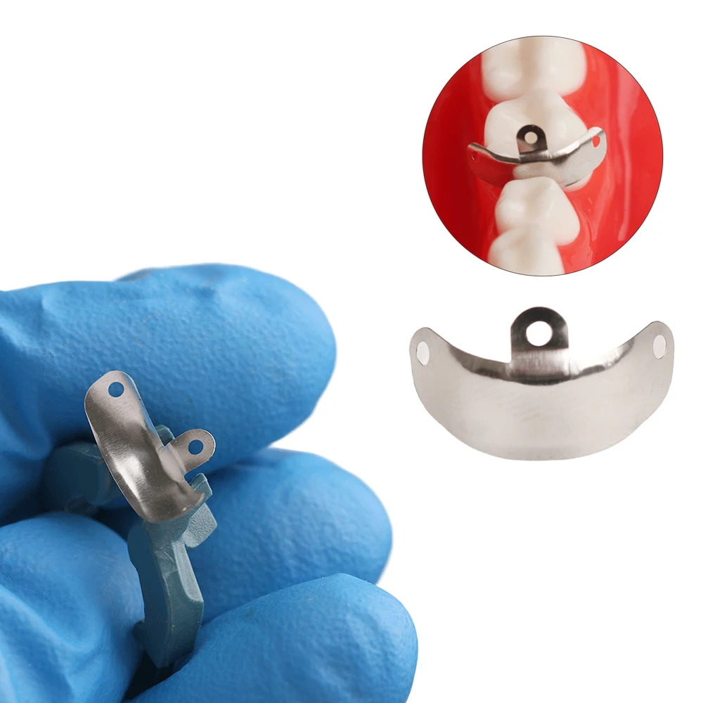 Bandas de matriz Dental NITI, anillo de abrazadera de Metal, sistema de matriz contorneada seccional, anillo de sujeción de titanio de níquel, herramientas de dentista