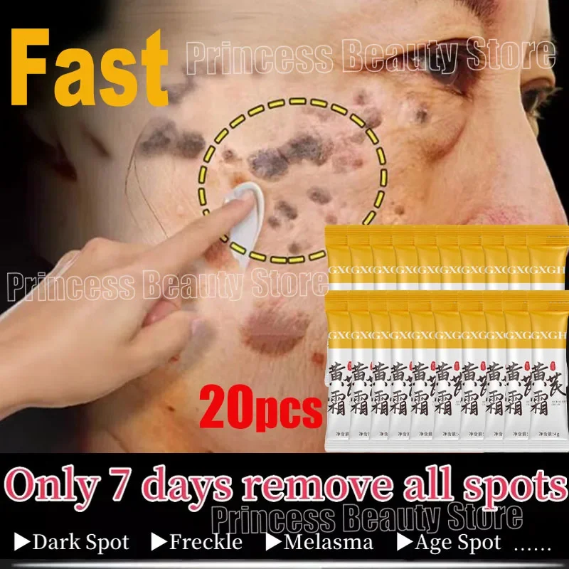 

Powerful Spot-removing Whiten Cream Brighten Skin Fast Eliminates Melanin Pigmentation Melasma Dark Spots Moisturize Beauty Gel