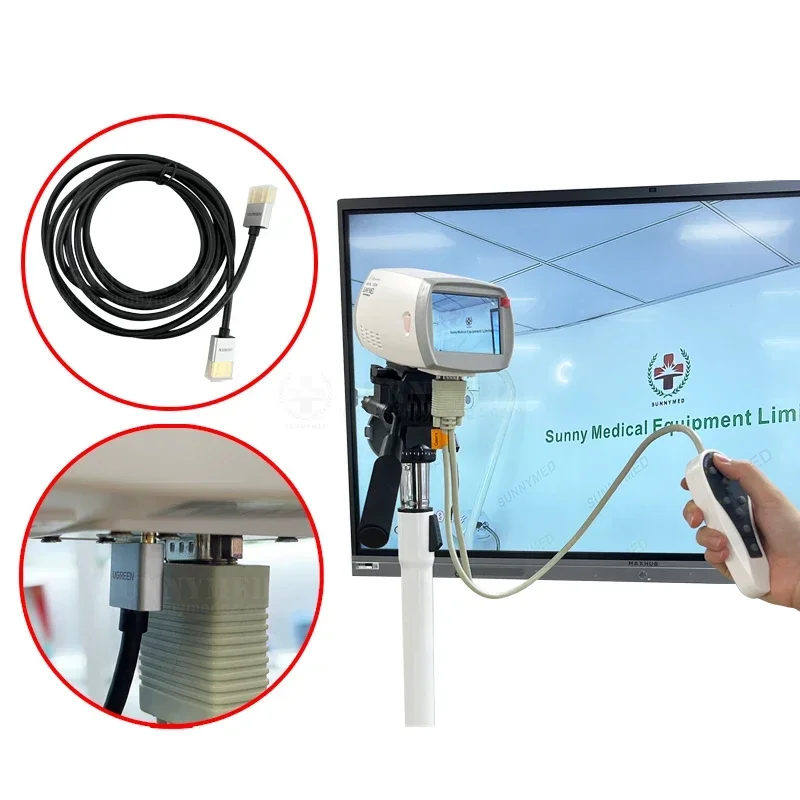 SY-F005HD-1 HD Digital Video Col Poscope for Gyne Cology Col Poscopy for Vagina S Digital Video Colpos Cope