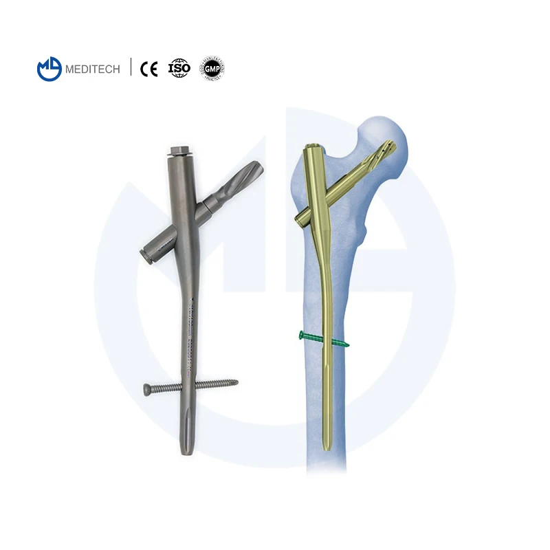 Instrumental Orthopedic Intramedullary Nail Pfna Femoral Reconstruction Interlocking Nail Intram