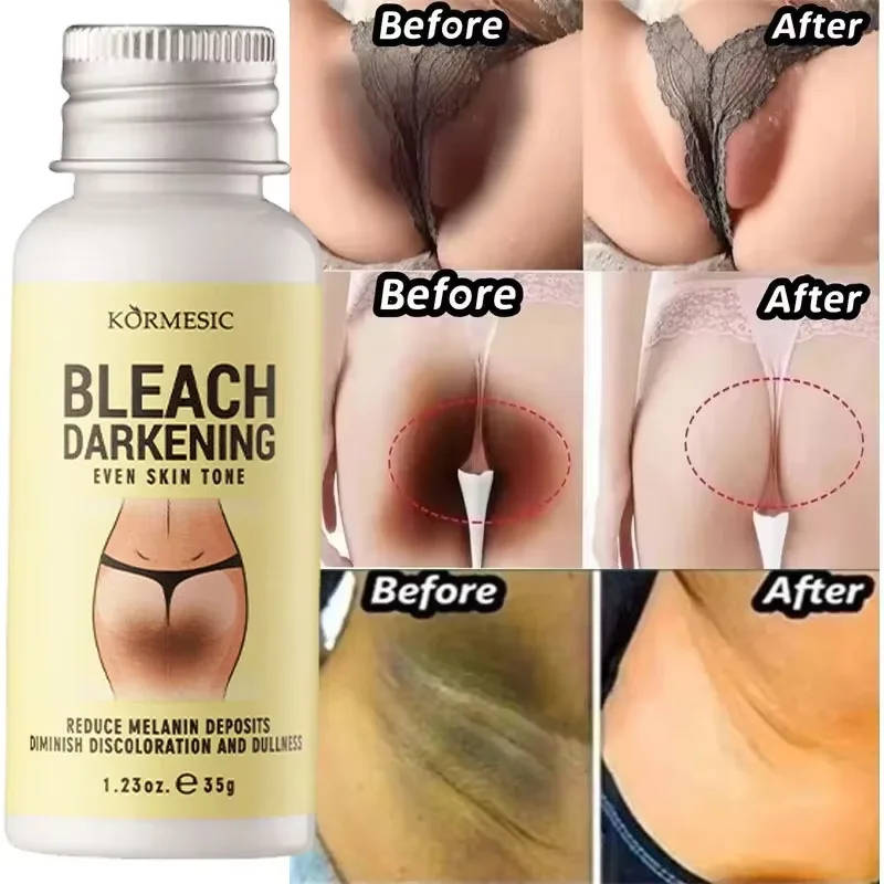 

Whitening Cream Private Parts Underarm Bleaching Serum Whiten Butt Knee Brighten Inner Thigh Intimate Parts Dark Remove Melanin