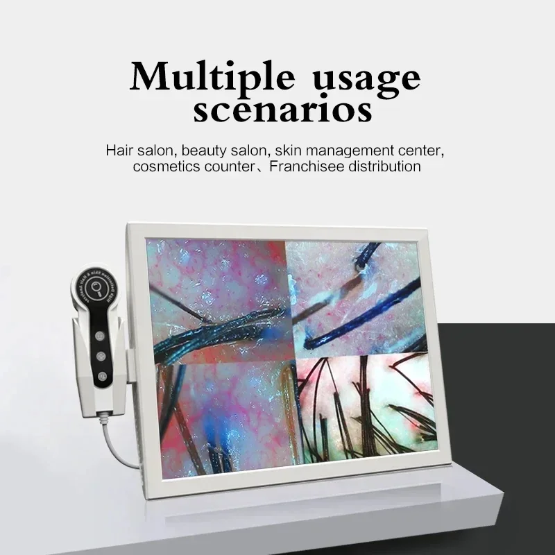 

15-дюймовый HD-дисплей 50/200X профессиональный детектор фолликулов для волос, диагностическая машина для кожи головы, анализатор кожи, тестер влажности и кожи