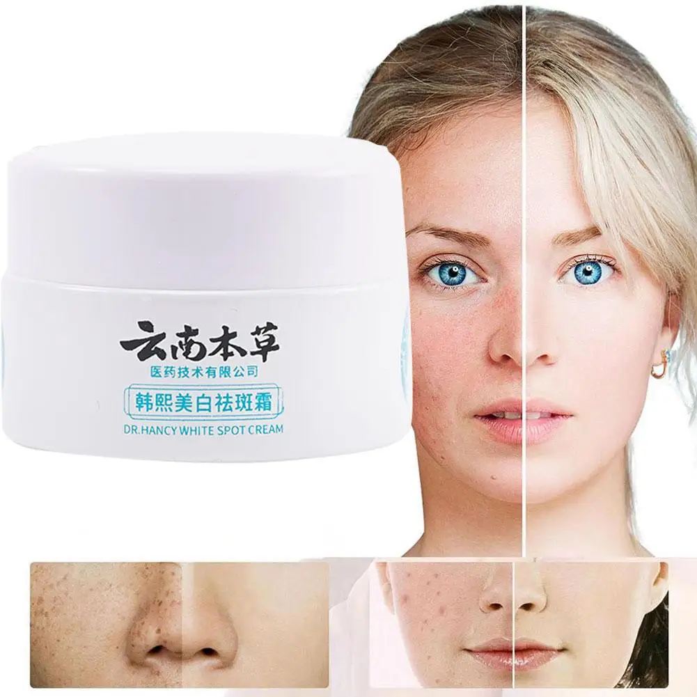 Yunnan Herbal Whitening Freckle Removal Cream Spot Fading Fade Spots Repair Cream Face Cream Skin Care Products 20g