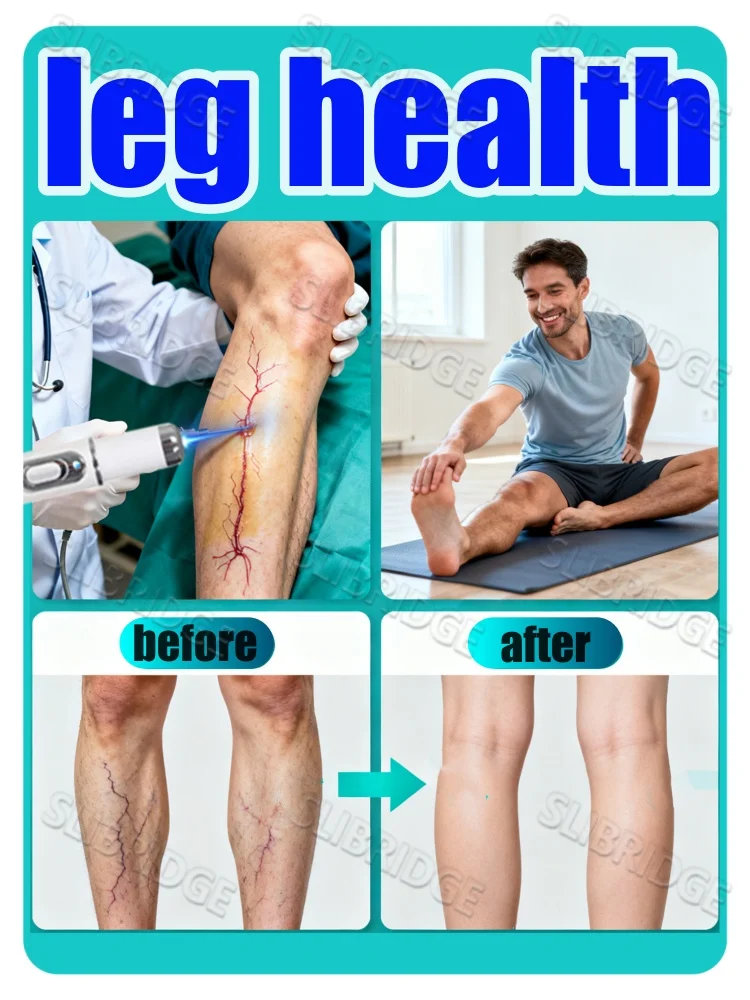 

Handheld light pen improves venous blood circulation in the legs; safe and reliable