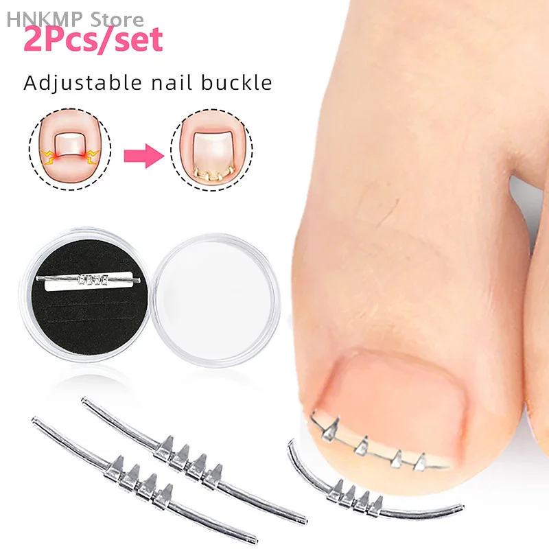 

2Pcs Professional Foot Care Correction Tool Ingrown Toenail Corrector Tools Pedicure Recover Embed Toe Nail Help Care Foot