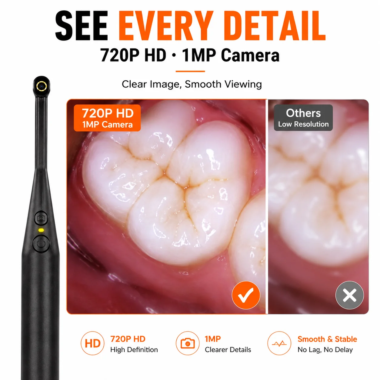 WiFi Dental Camera 720P HD 1MP Wireless Oral Inspection Camera for Teeth Skin Scalp Hair Pet, iOS Android Smartphone