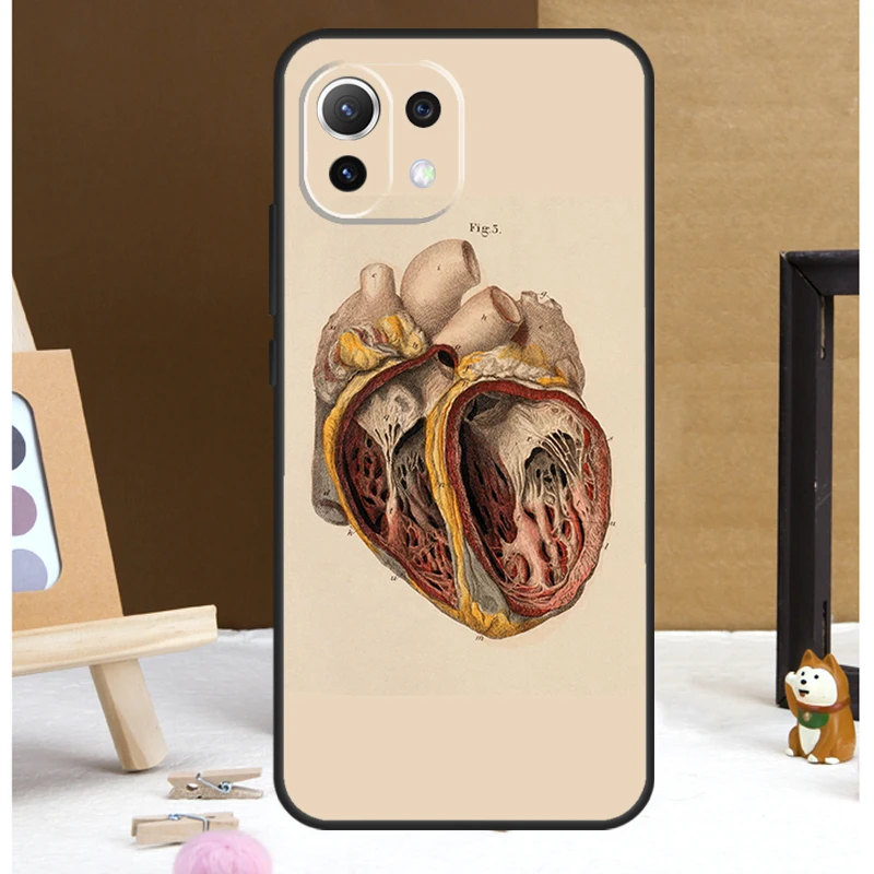 Medical Human Anatomy Case For POCO X6 Pro M6 X3 X4 X5 F3 F5 M5s Xiaomi 13 14 Ultra 12 Lite 11T 12T 13T Pro Cover