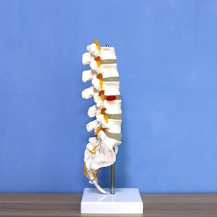 lumbar model Spinal nerve model caudal equina nerve lumbar spine disc model Spine Chiropractic skeleton model