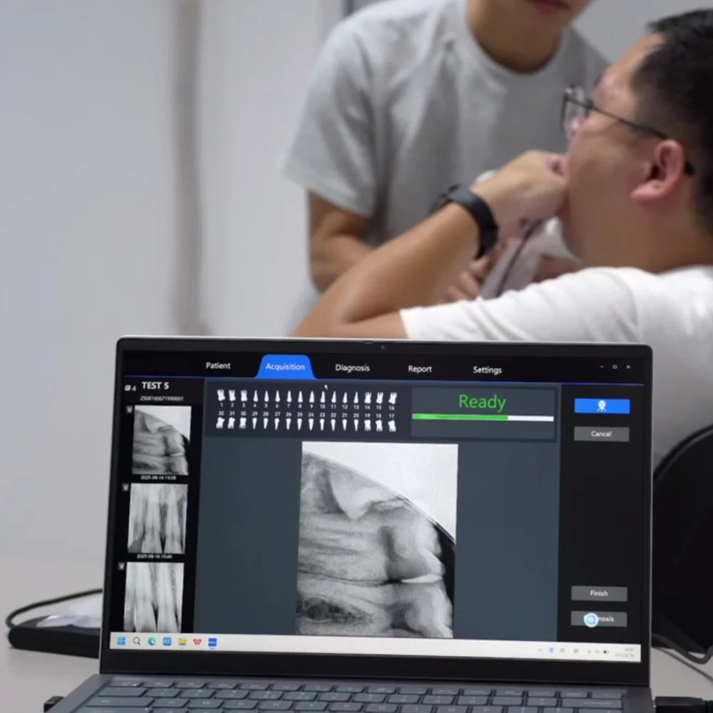 Sensore AI dentale Nuovo aggiornamento Sistema di assistenza Al Sensore HD, diagnosi intelligente, riconoscimento delle strutture, rilevamento delle carie