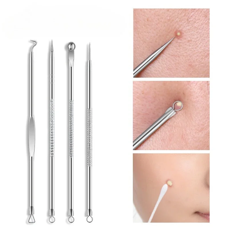 4 Stuks Puistje Popper Tool Kit Comedondrukker Acne Naald Gereedschap Set Verwijderen Zorg Whitehead Popping Acne Remover Huidverzorging gereedschap