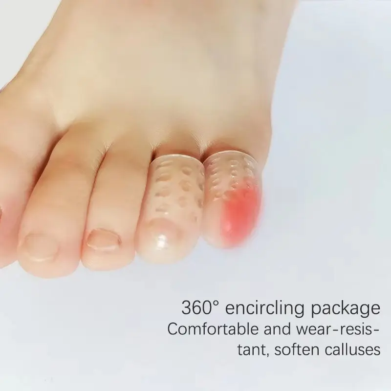 10 Stuks Siliconen Neus Beschermers Anti-Frictie Ademende Teenhoes Voorkomt Blaren Bunion Corrector Voetverzorging Pedicure Tool