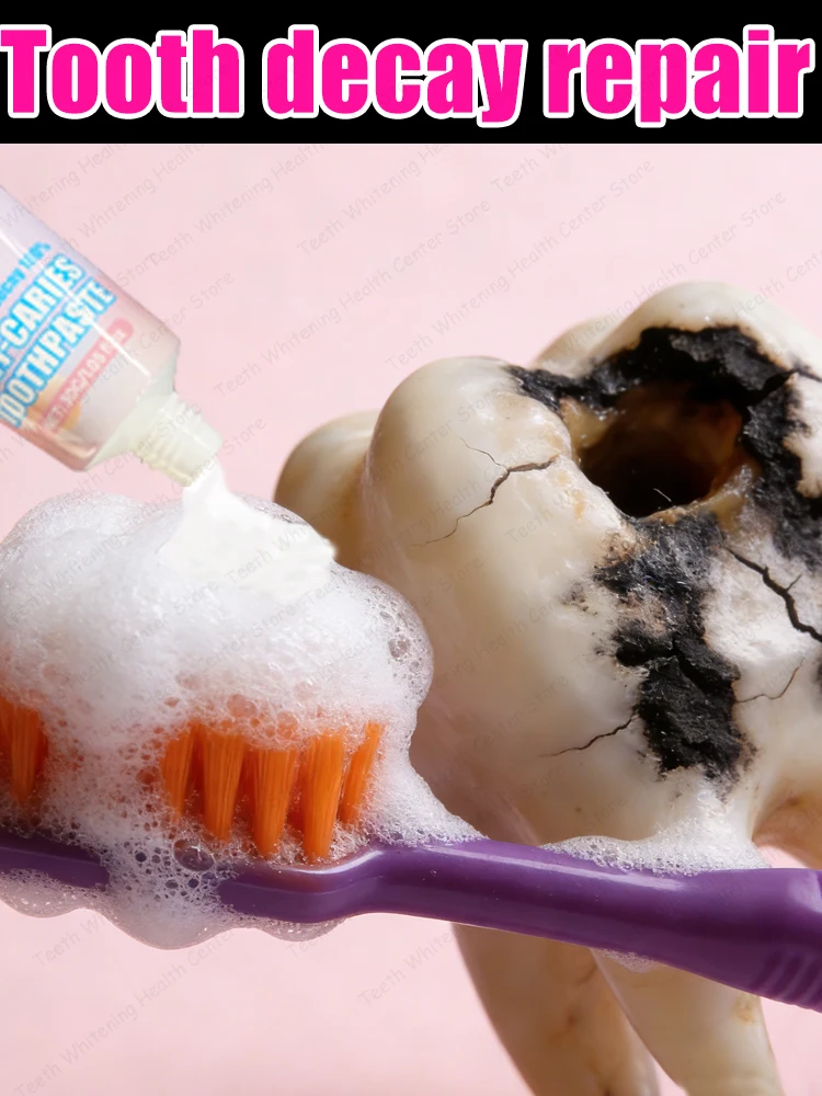 

Глобально популярная зубная паста, которая может восстанавливать полости в 3-днем спектакле