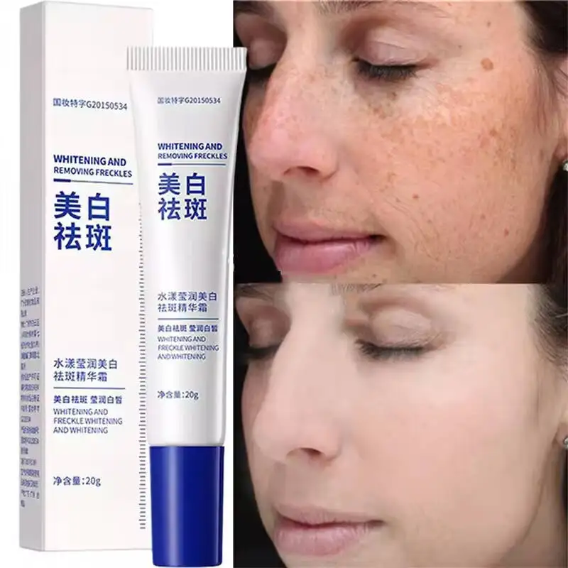 

Whitening Freckle Cream Effective Remove Melasma Cream Remove Dark Spots Melanin Moisturize Brighten Smooth Face Skin Care