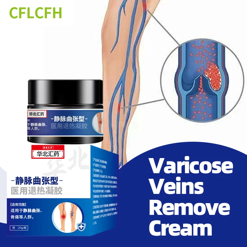 20g Varicose Veins Remover Herbal Cream Spider Legs Varicosity Angiitis Vascular Veins Treatment Chinese Medical Plaster