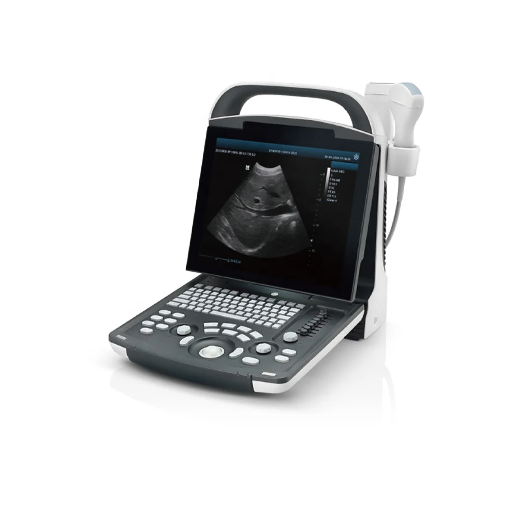 Mindray DP-10 Full Digital Portable Ultrasound Diagnostic System Black And White Obstetric Ultrasound System For Human