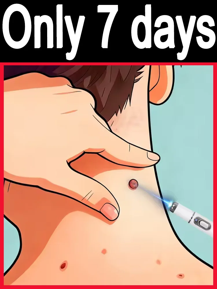 

Deeply kills warts without leaving any residue! ᴿᵉˢᵗᵒʳᵉˢ ˢᵐᵒᵒᵗʰ ˢᵏⁱⁿ ᵗᵉˣᵗᵘʳᵉ‧