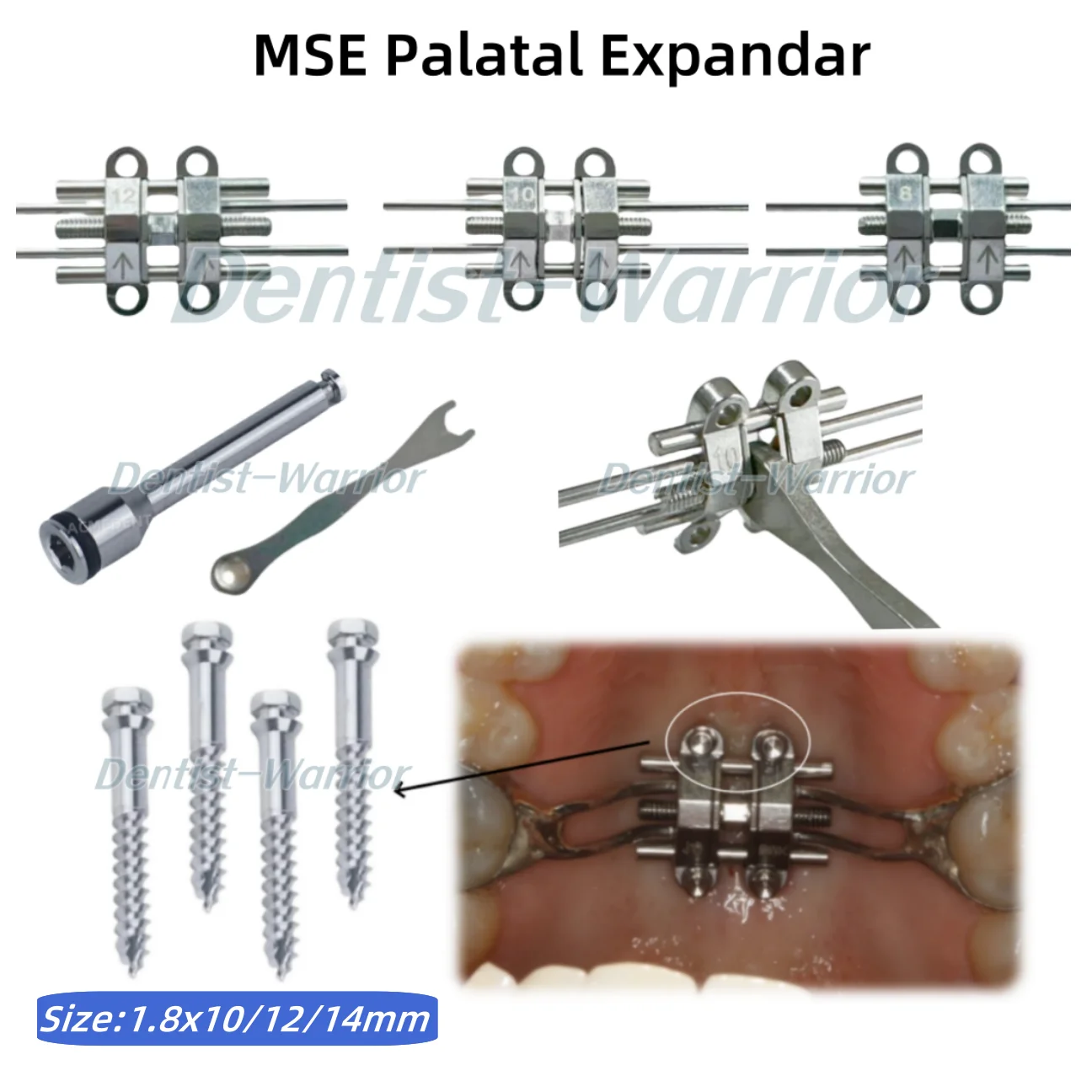 MSE Dental Orthodontics Expansion Screw Mid Facial Rapid Palatal Split Maxillary Expander 8/10/12mm