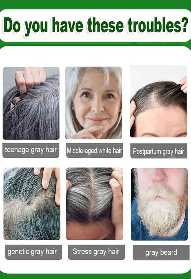 Anti-Grey Hair Essence - Natural Solution for Premature Greying