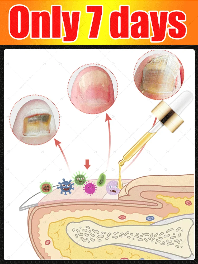 Nagelreinigingshulpmiddel, nail art stickers, vaarwel nagelproblemen