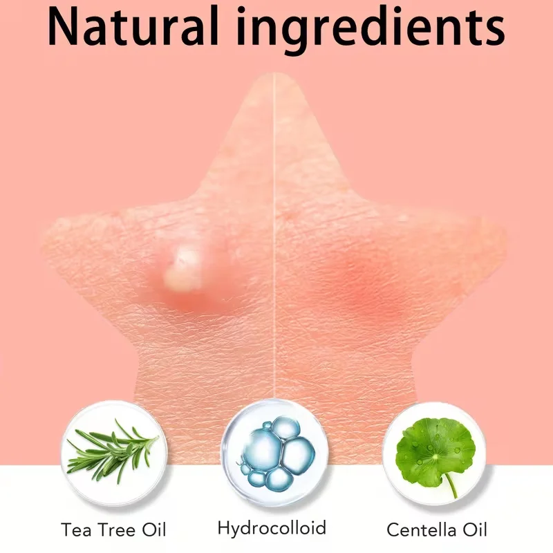 360 adesivos coloridos para acne – cobertura facial suave para espinhas e acne, adequados para todos os tons de pele clara a bege, sensíveis.