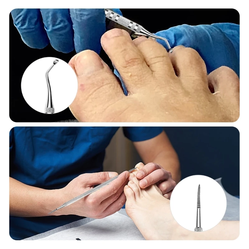 Les patchs correcteurs d'ongles incarnés le tampon remplissage éliminent les ongles ennuyeux, livraison directe