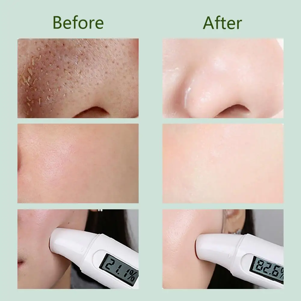 안토시아닌 버블 페이스 마스크 수축 모공 블랙헤드 부드러운 스킨 케어 제거 보습 페이셜 마스크 머드 O9Q7