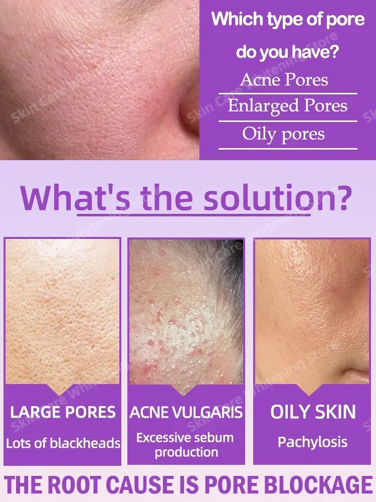 Pore Shrinking Serum Face Pores Remover Serum