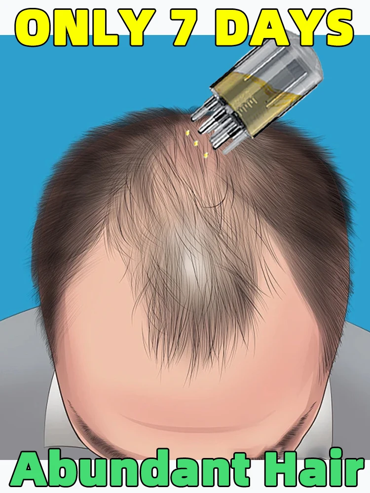 Applicator,hair scalp massager,suitable for hair growth assembly,liquid guide comb,massager massage tool,Hot Sale,Free shipping