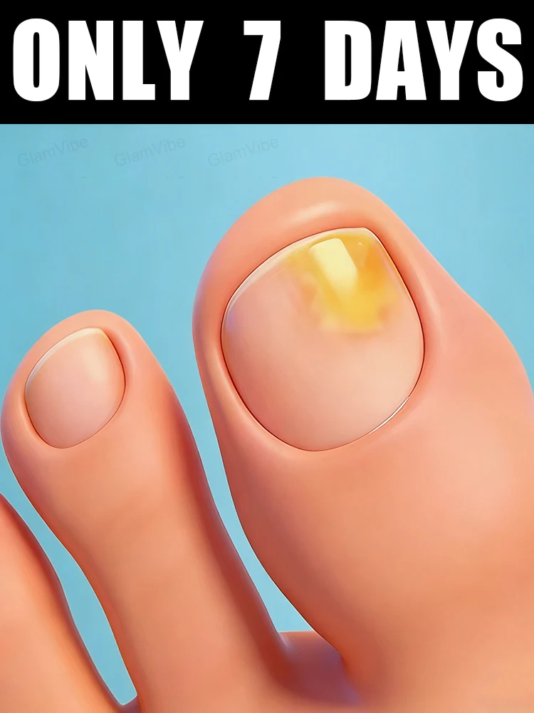 

New 2026 Offer! Free Shipping! Tea Tree Nail Solution 10ml