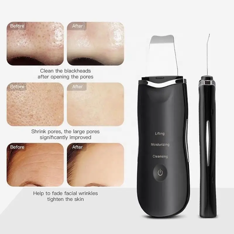Portable Dead Skin Blackhead Remove Lon Ultrasound Facial Spatula Face Peeling Skin Scrubber Ultrasonic