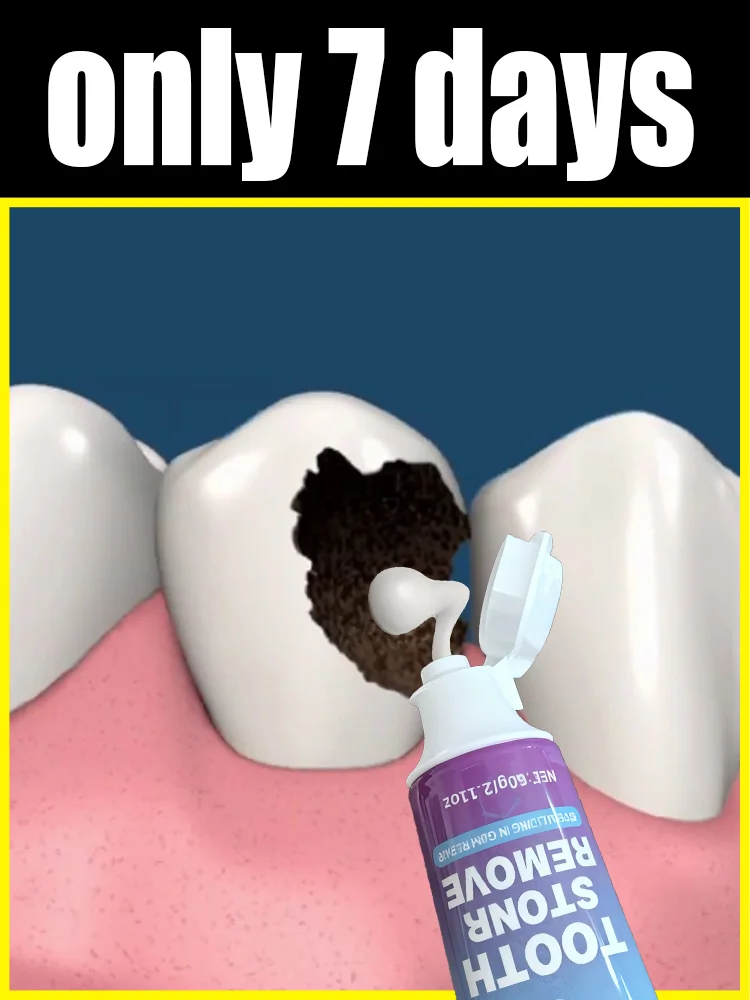 

Sᴀʏ ɢᴏᴏᴅʙʏᴇ ᴛᴏ ᴄᴀᴠɪᴛɪᴇs ᴀɴᴅ ʀᴀᴅɪᴀᴛᴇ ʏᴏᴜʀ ʙʀɪɢʜᴛᴇsᴛ sᴍɪʟᴇ!