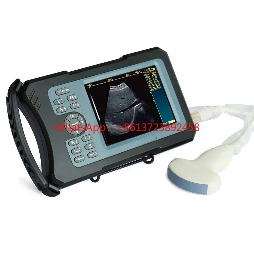 

Upgrade 5.6 Inch Farm Animal Veterinary B-ultrasonic Machine HD Scanner Portable Pig Cattle Sheep Ultrasound