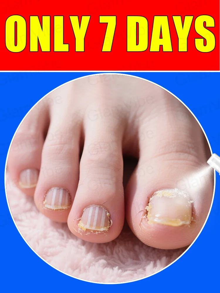 

2025 Toenail Fungus Patch Waterproof Nail Repair Patches Nail Ingrown Correction Sticker Discolored Damaged Nail Foot Care Tool