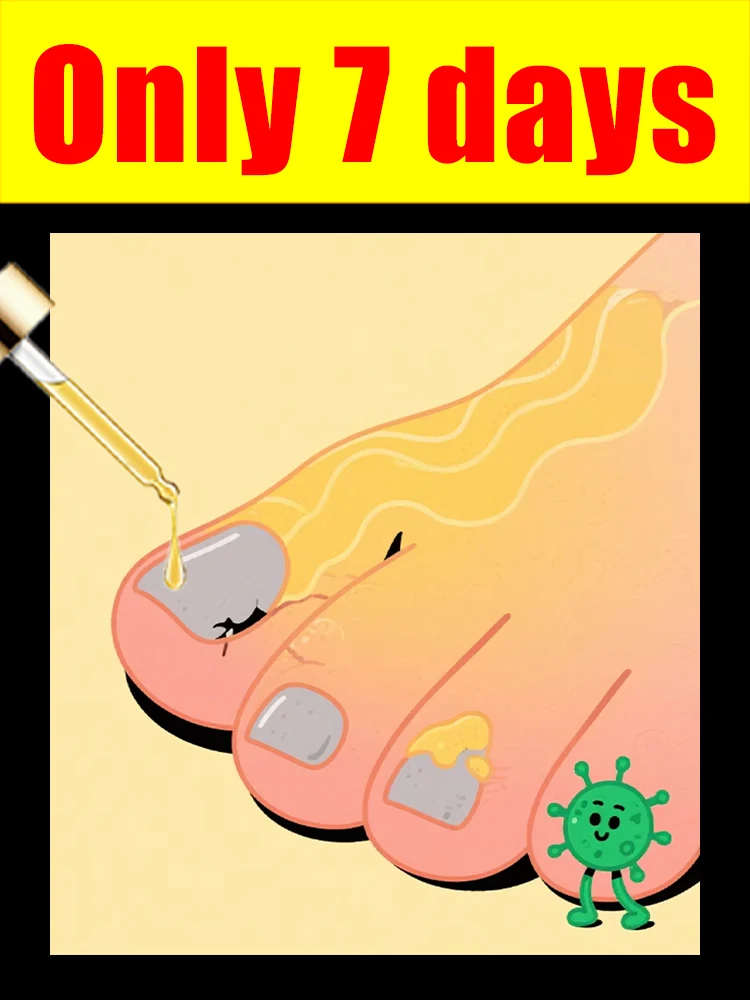 ترقية الجيل الثانيإصلاح جذر فطريات Naṁl بسرعة #1