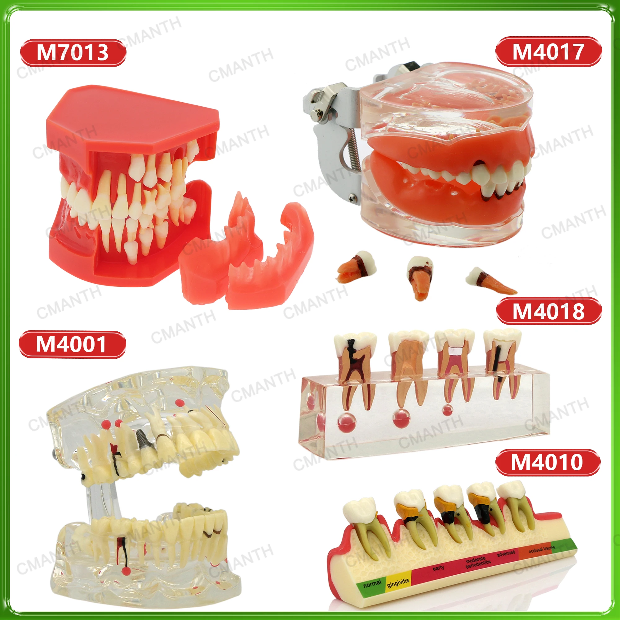

Dental Teeth Teaching Model Restoration Pathological Tooth Model Removable Dental Teaching Study Demo Dentist Training