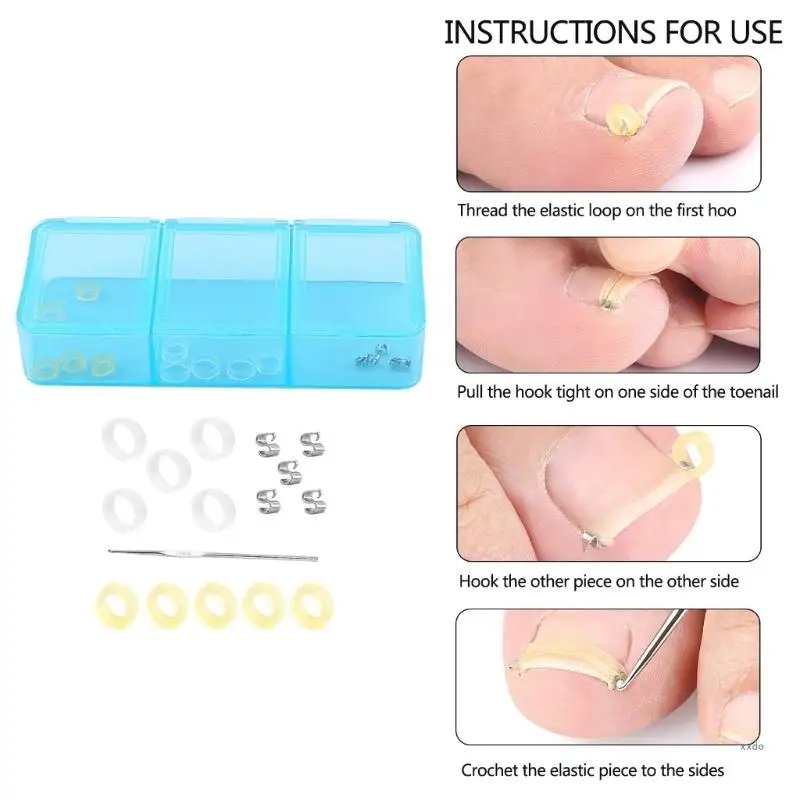 Ingrown Toenail Corrector for Ingrown Toenail Correction Paronychia Corrector Tool Stainless Steel Pedicure Tool