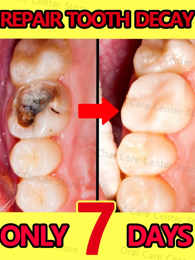 Clean cavities, whiten teeth, fight cavities, remove plaque, freshen breath, treat periodontitis