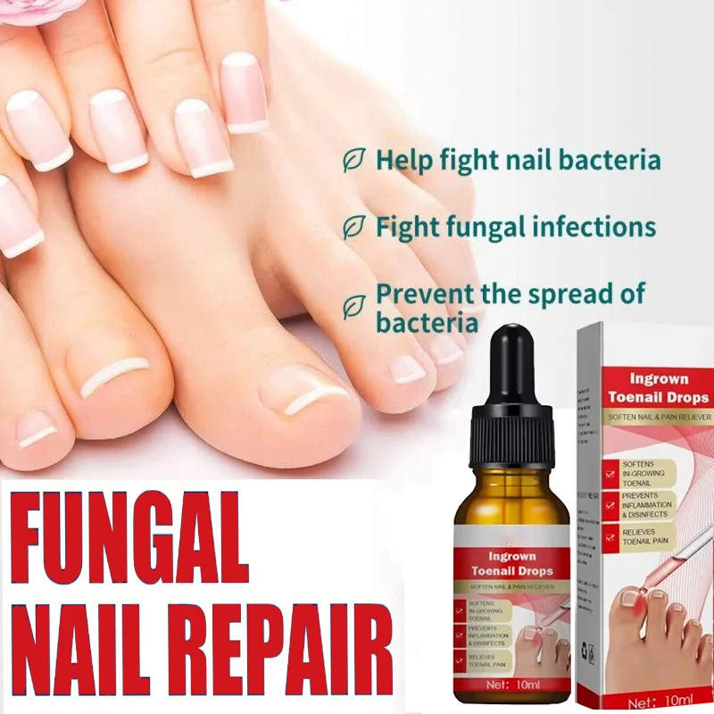 7 Day Nail Fungal Treatment Serum Foot Toe Nail Fungus Removal Essential Oil Anti Infection Onychomycosis Paronychia Repair Gel