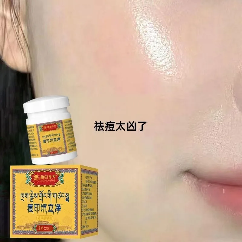 Blemish & Pimple Corrector Cream - Minimizes Appearance of Acne Scars & Spots, Soothes Irritated Skin Promotes Smoother Texture