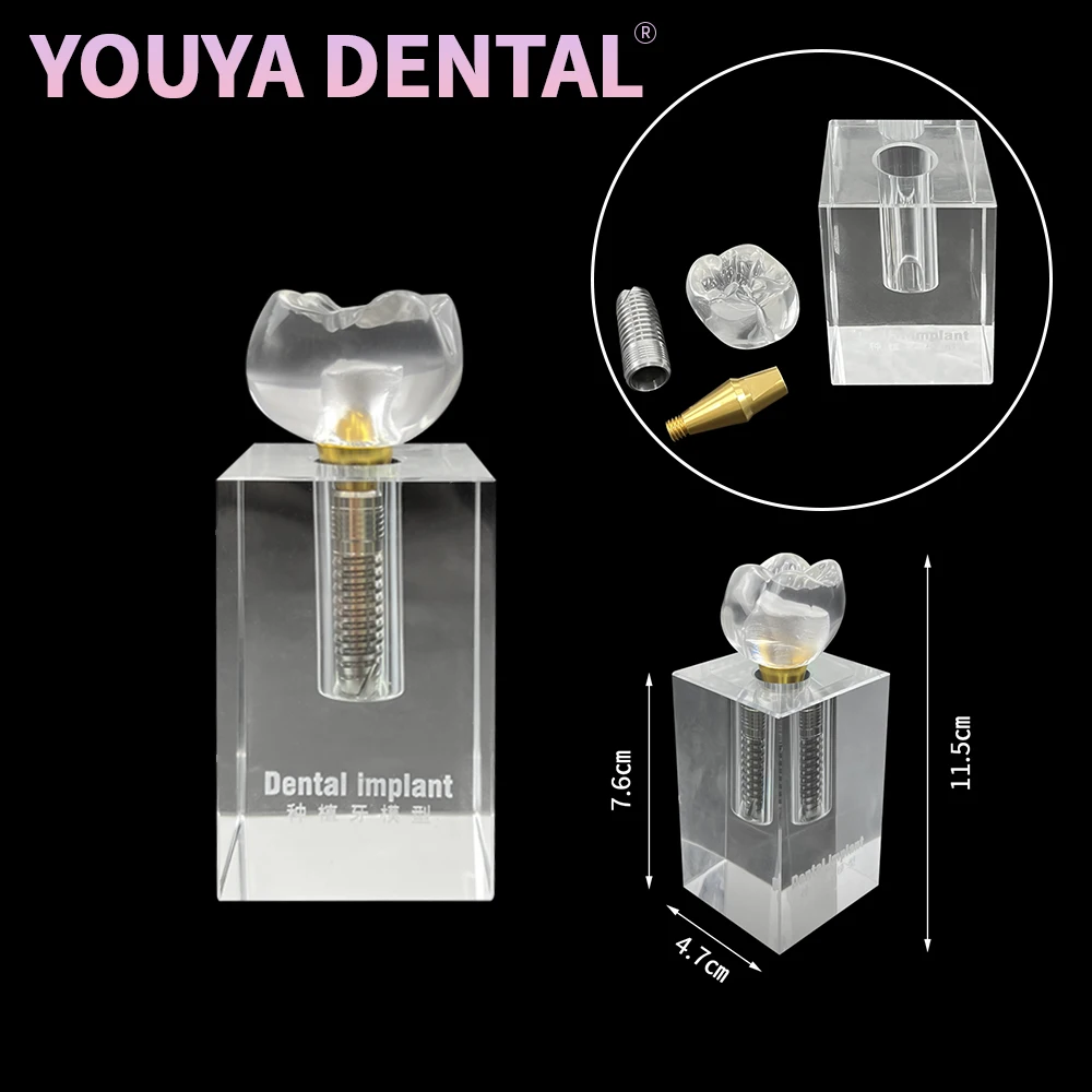 

Dental Removable Crystal Implant Model Transparent Crown Base Analysis Research Teaching Model Suitable For Dental Demonstration