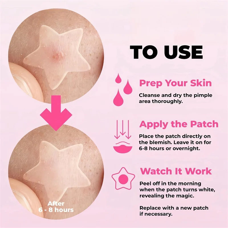 40/432 Uds. Parches coloridos para espinillas de PE, pegatina para cubrir espinillas en forma de estrella, cubierta Invisible para espinillas, parche para quitar espinillas