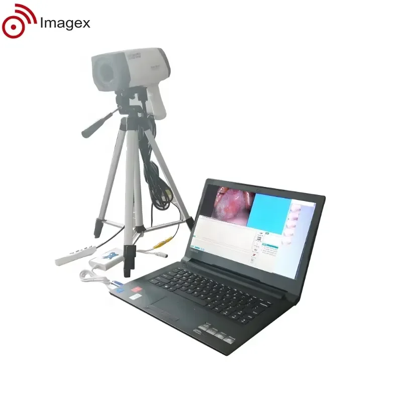 Digital Video Microscope with CCD for Gynecological Clinics