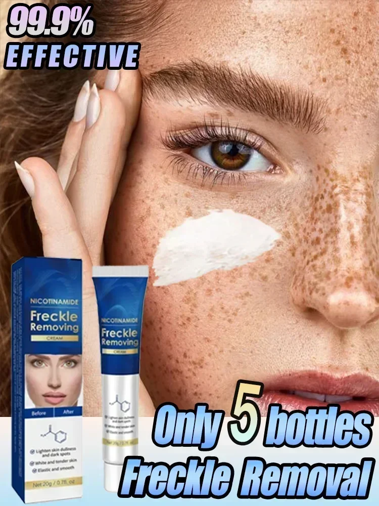 Removedor de manchas oscuras para la cara, eliminación de pecas, placas seniles, quemadura solar, crema para pecas