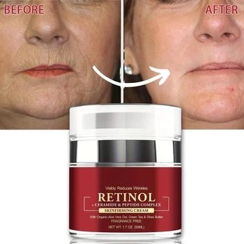 Instant Retinolครีมริ้วรอยRemoverกระชับAnti Aging Fade Fine Lines Moisturizing Whitening Korea Repair Skin Care