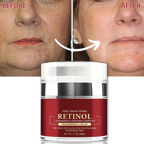 Crema de Retinol instantánea, eliminador de arrugas, reafirmante, levantamiento, antienvejecimiento, decoloración de líneas finas, blanqueamiento hidratante, reparación coreana, cuidado de la piel