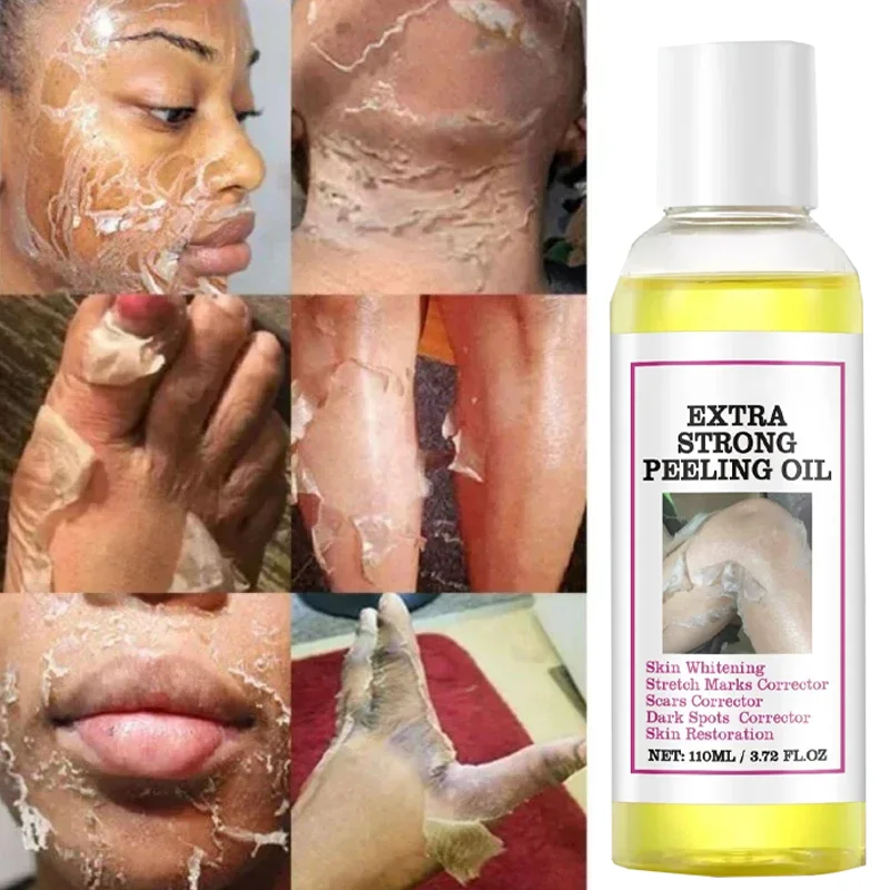 زيت لوشن تقشير أصفر 100% تبييض عضوي للبشرة الداكنة وتقشير وتبييض ومغذي وحمض الهيالورونيك ومرطب للجسم #2