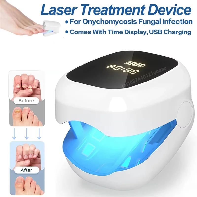 TKOH-علاج فطريات الأظافر LED جهاز ليزر 905Nm ضوء الأشعة تحت الحمراء 470Nm الضوء الأزرق USB تهمة ل فطار الأظافر للتنظيف #3
