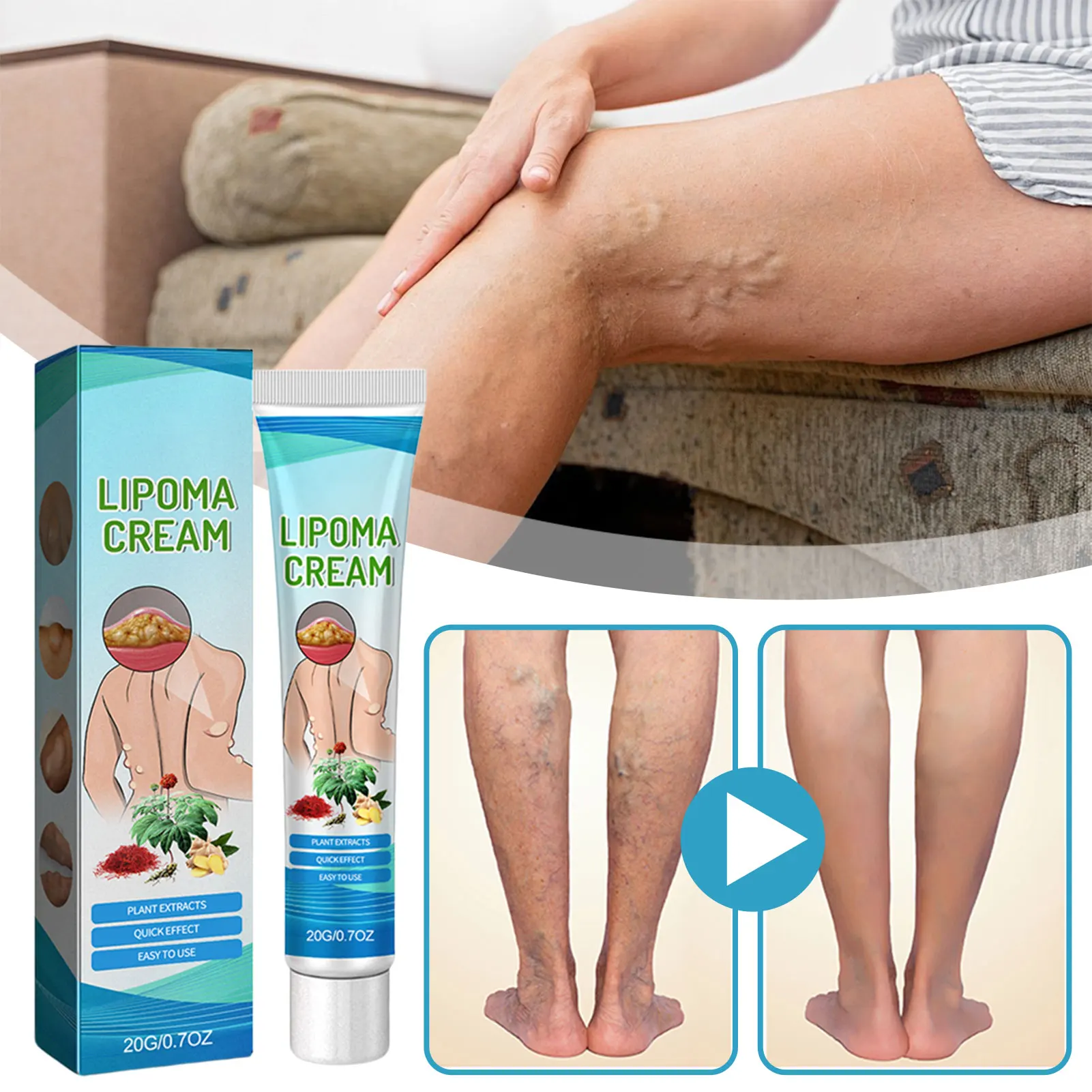 

1/2/3pcs Lipoma Removal Cream Natural Herbal Formulas Subcutaneous Mass Dredging Care Cream Varicose Vein Relief Cream 20g