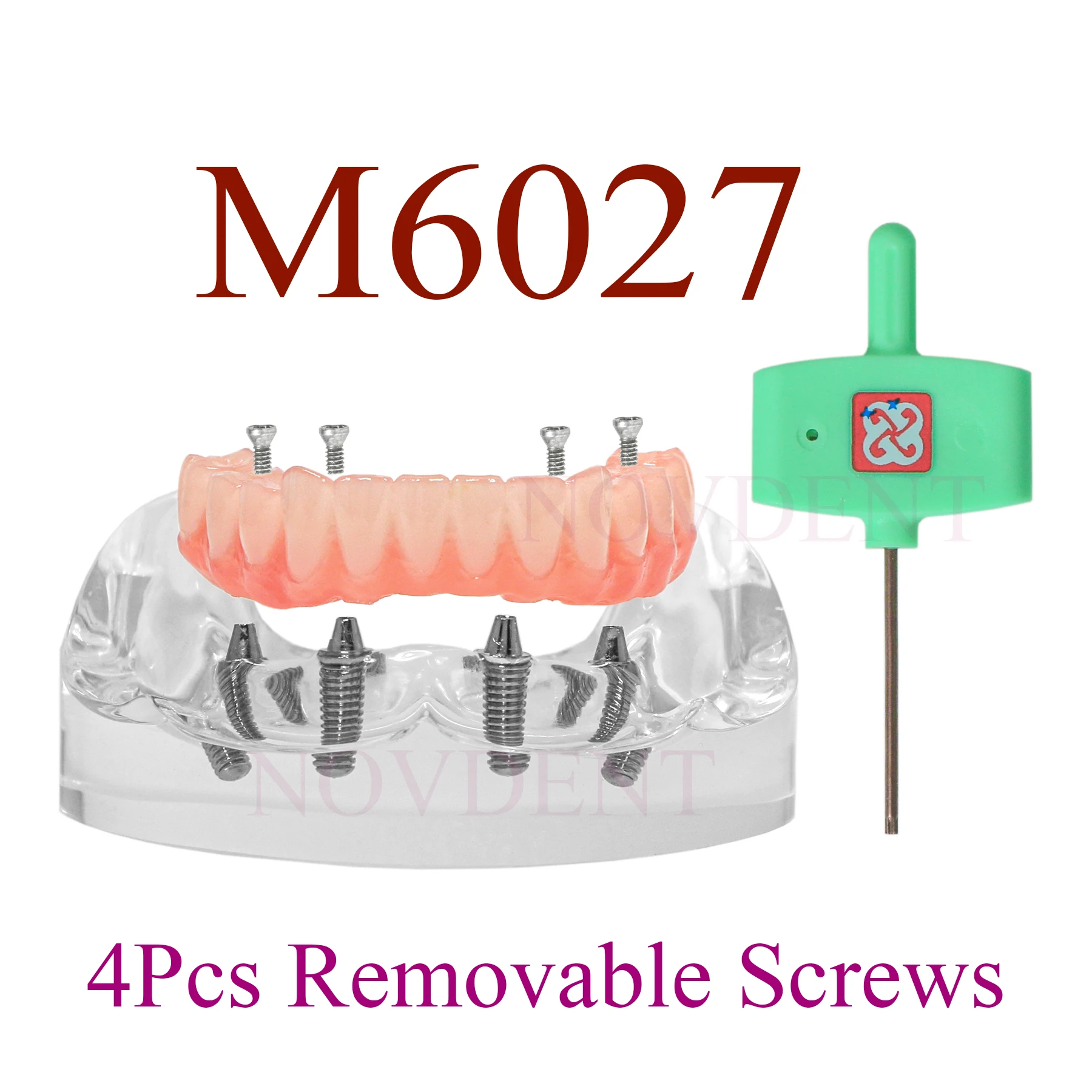 Dental 4 Implants Lower Jaw with Overdenture Model Dental Implant Teeth Model M6027 With 4 Removable Screws