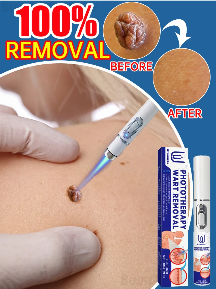 

Pʀᴏғᴇssɪᴏɴᴀʟ sᴏʟᴜᴛɪᴏɴ ᴛᴏ sᴋɪɴ ᴘʀᴏʙʟᴇᴍs